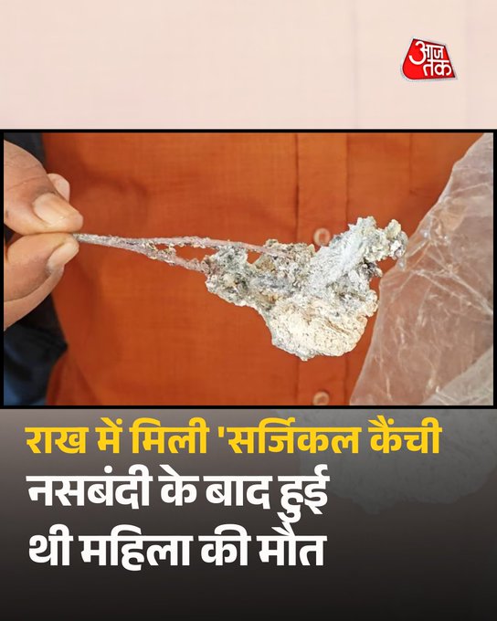 चिता की राख में मिली 'सर्जिकल कैंची', नसबंदी के बाद हुई थी महिला की मौत, स्वास्थ्य विभाग में मचा हड़कंप  मध्य प्रदेश के सीहोर जिले में हैरान करने वाला मामला सामने आया है. जहां एक महिला की मौत के बाद अंतिम संस्कार की राख में सर्जिकल कैंची मिली है. परिजनों का आरोप है कि नसबंदी ऑपरेशन के दौरान डॉक्टर ने महिला के पेट के अंदर ही कैंची छोड़ दी थी.